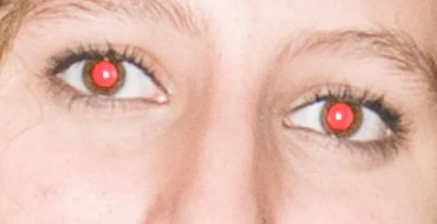 Close-up of a person&#x27;s eyes with red-eye effect from camera flash