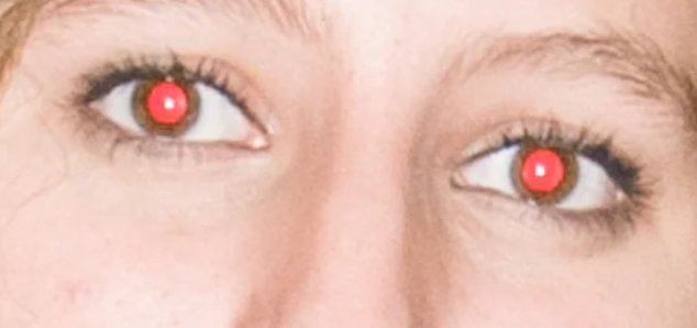 Close-up of a person's eyes with red-eye effect from camera flash