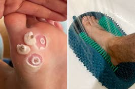 But if you plan on doing something about your feet, you probably should read this.