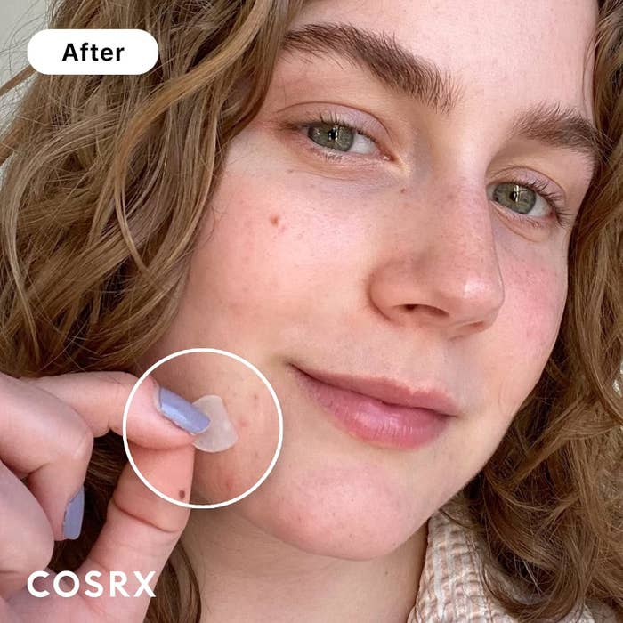 Woman showing skin improvement using COSRX product, holding a patch on her cheek