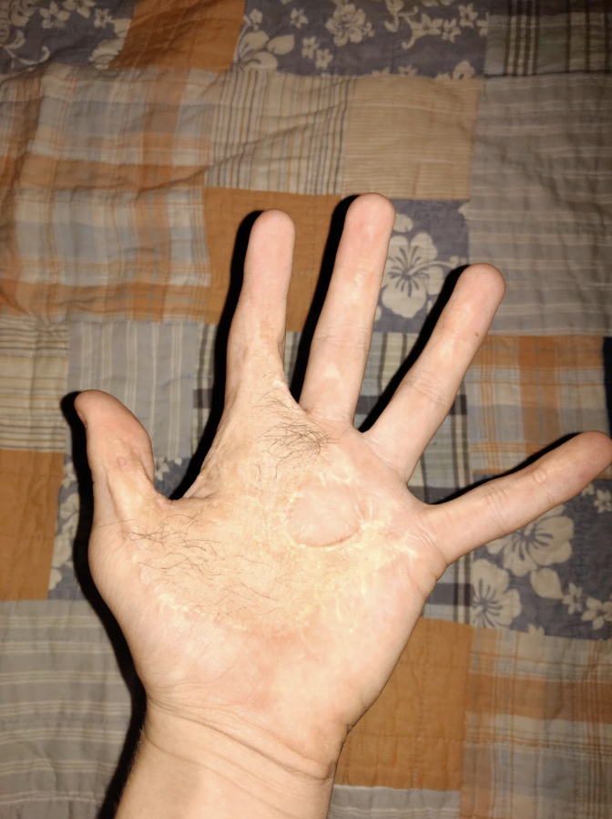 A person&#x27;s palm facing the camera with fingers spread apart