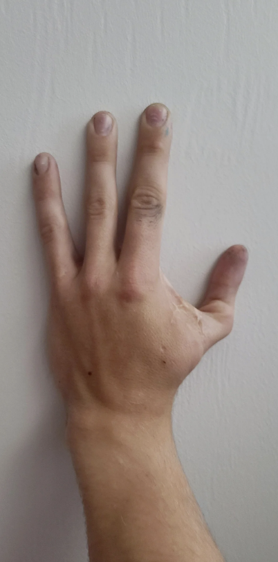 A person&#x27;s right hand making a three-fingered gesture against a plain wall