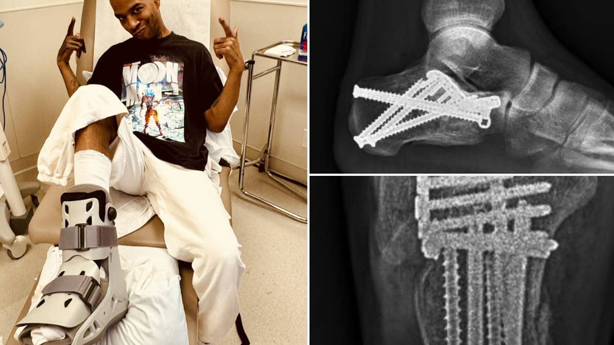 "Heres some xrays after the surgery, I wanted yall to see how real this shit was," Cudder told his fans.