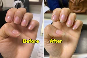 Comparative image of hands showing nail condition before and after a product use