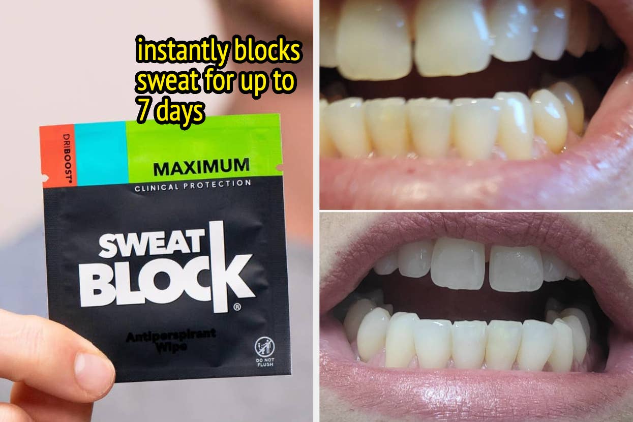 A hand holding a pack of Sweat Block antiperspirant wipes, with two close-up images of teeth before and after use