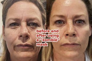 A reviewer's face before and after using a "zombie" mask, showcasing the skincare product's effects