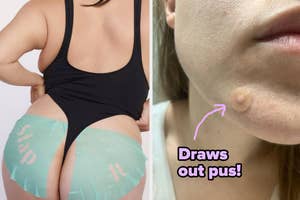 model using butt mask and reviewer with mighty patch on pimple