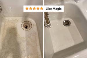 before/after of a dirty stained sink that's been cleaned, and a 5 star review saying "like magic"