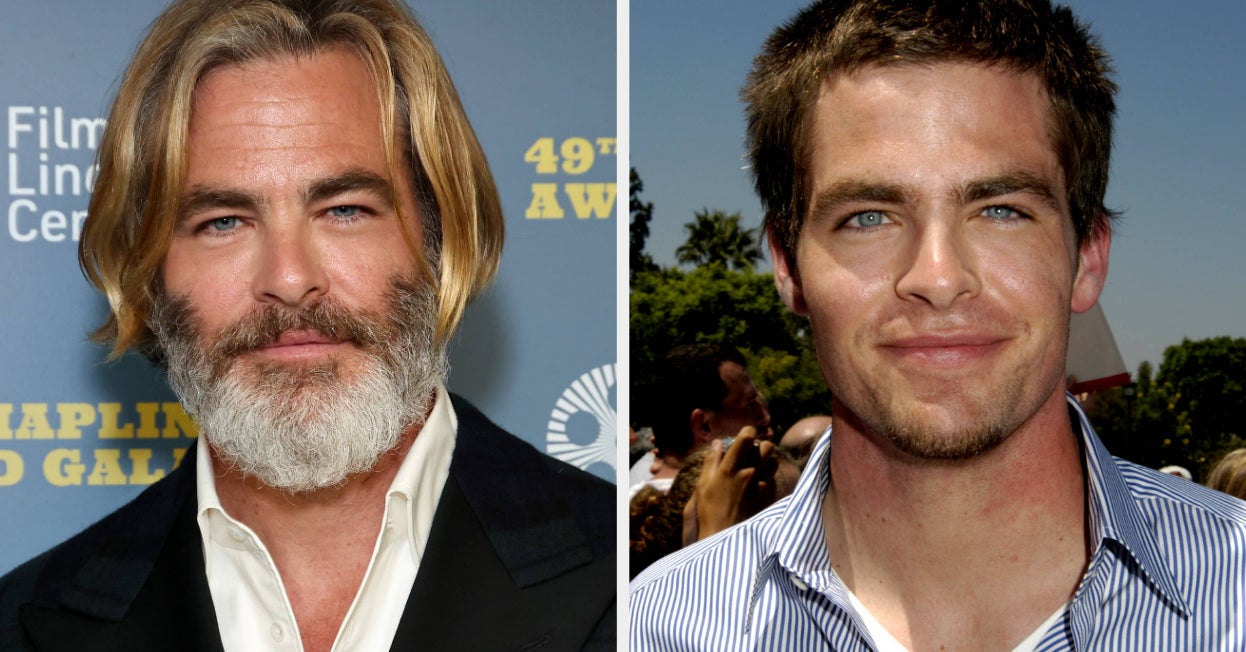 Chris Pine Said It Was “Traumatic” Going To Auditions While Battling “Emotionally Incapacitating” Acne At The…