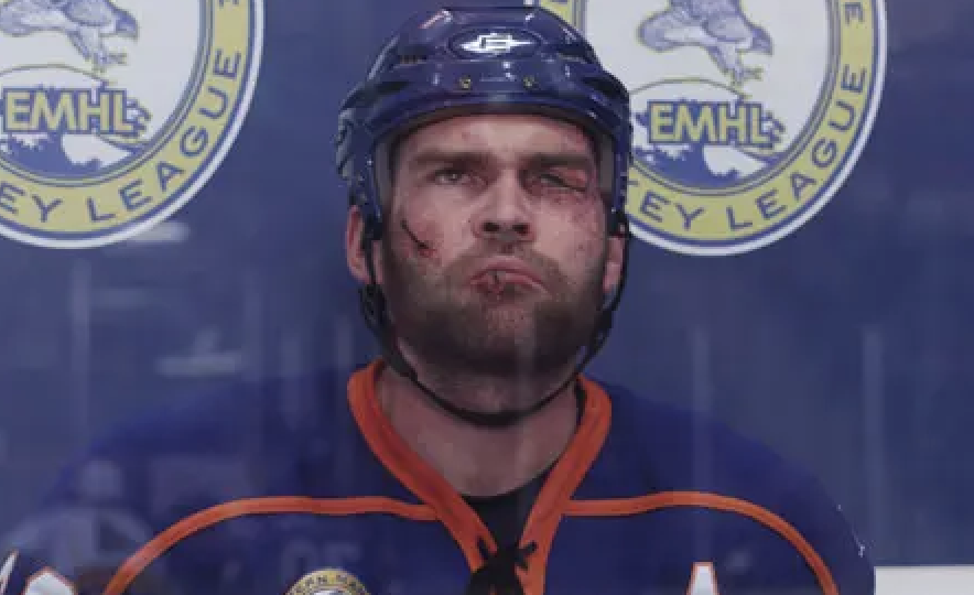 Hockey player in blue uniform with helmet, making a grimace, possibly after a play or during a break in the game