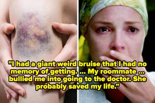 sad izzy on grey's and bruise on leg captioned "I had a giant weird bruise that I had no memory of getting. ... My roommate ... bullied me into going to the doctor. She probably saved my life"