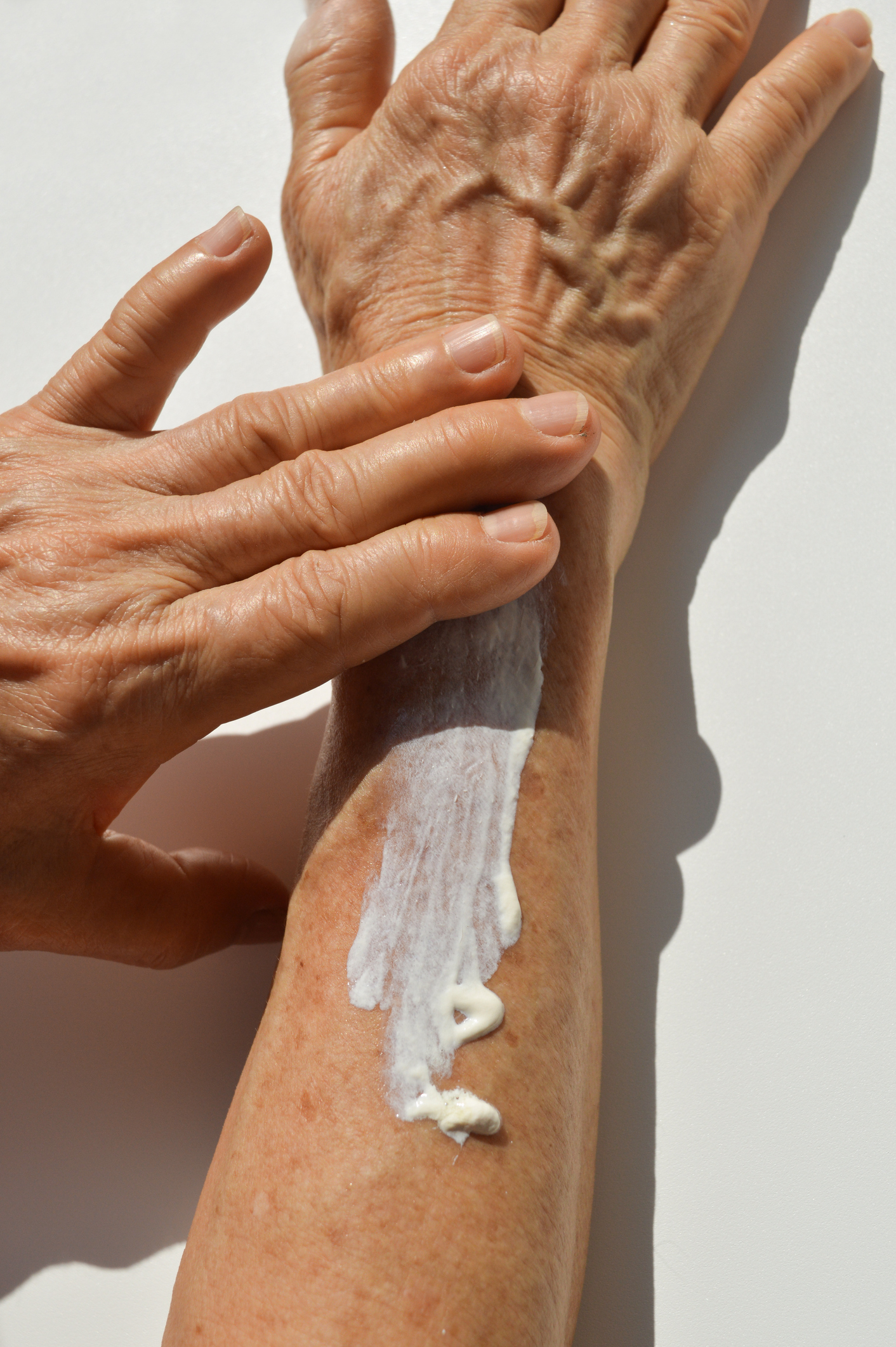 Person applying lotion to their arm with visible veins and spots, skincare routine