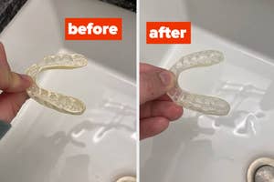a before and after for retainer cleaning tablets