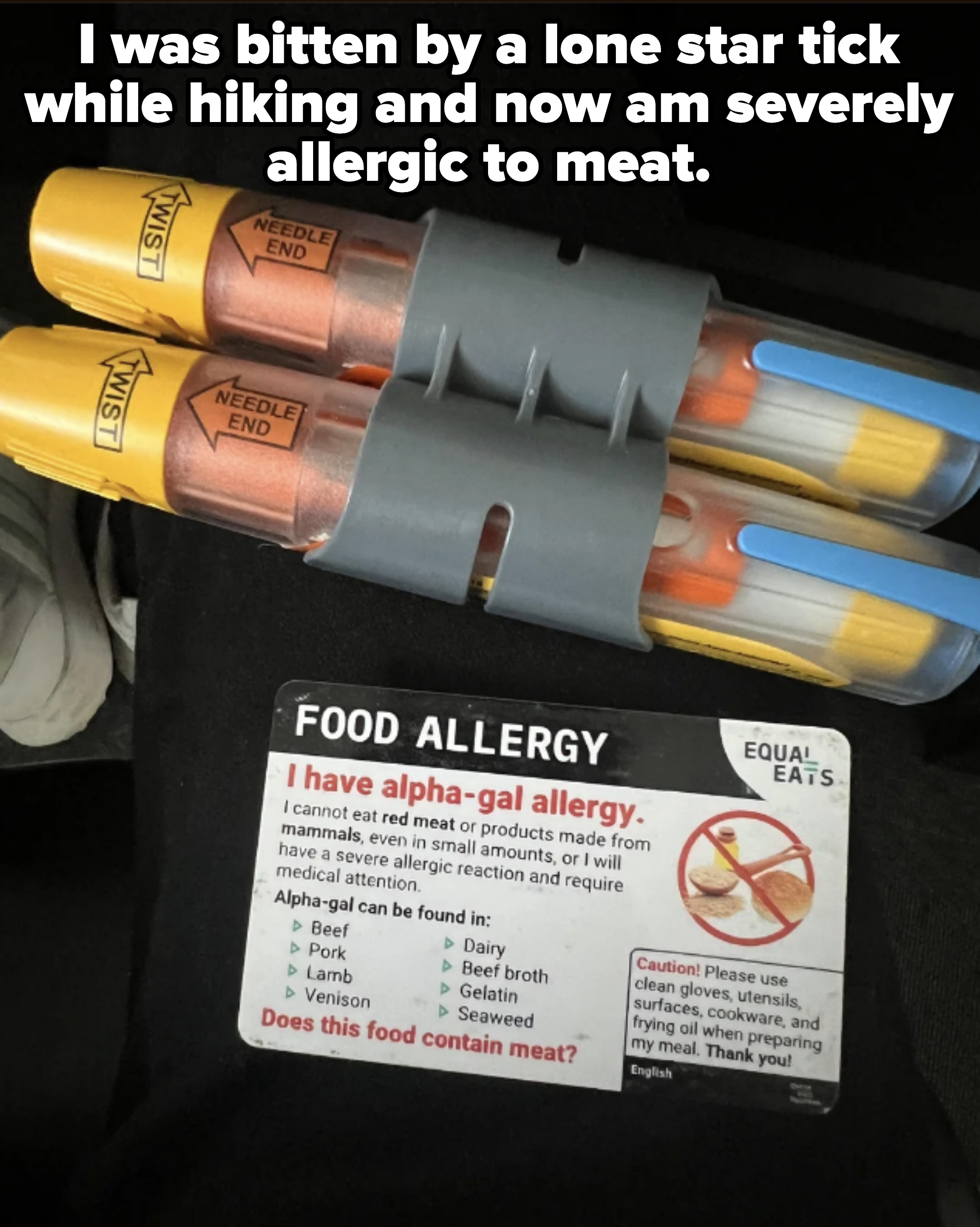 Person's lap with EpiPen trio and a card stating their alpha-gal allergy, cautioning against multiple foods