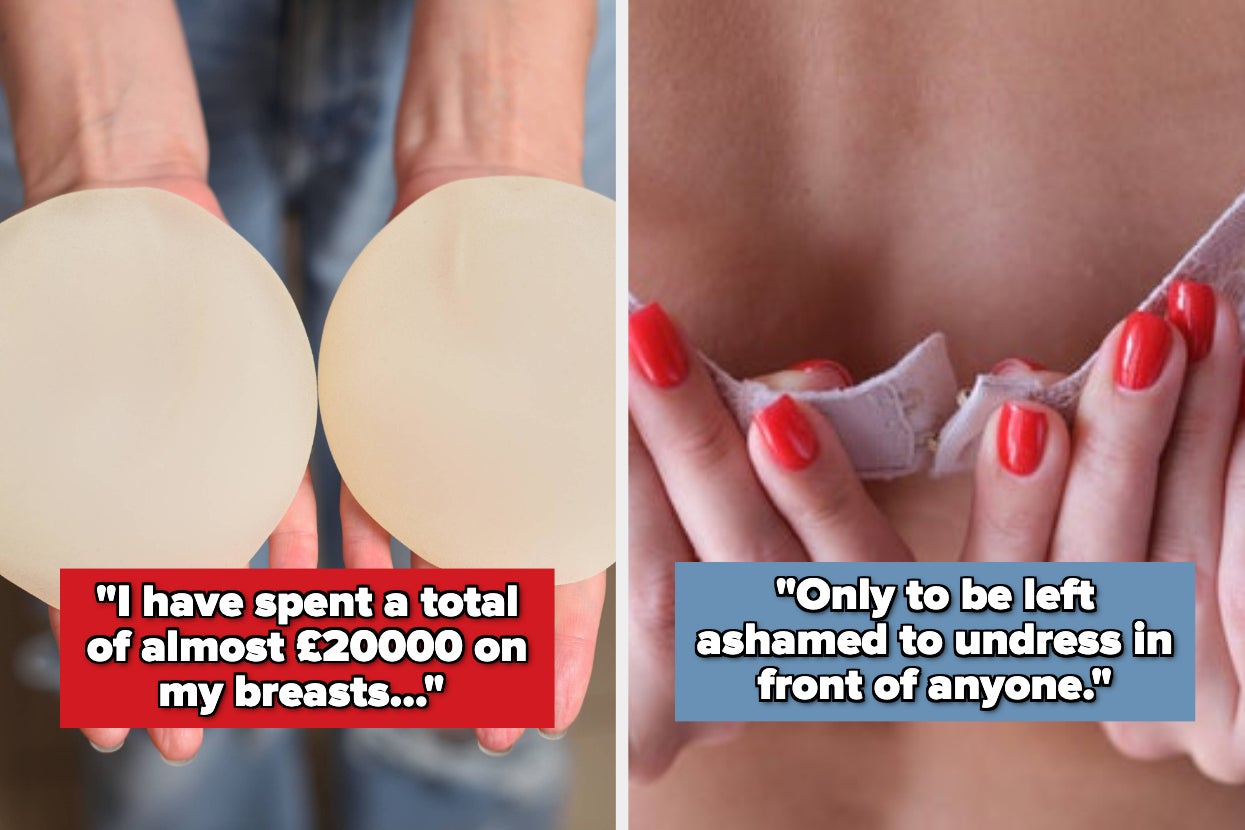 People Who Regret Getting Cosmetic Work Done Are Sharing What Happened