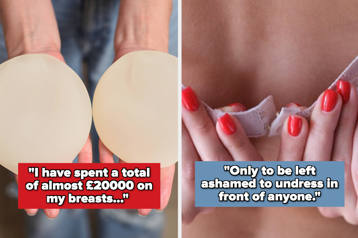 11 People Who Regret Getting Cosmetic Work Done Are Opening Up About Where It All Went Wrong