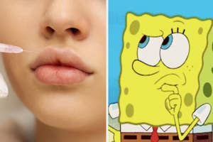 Close-up of a lip filler procedure and worried SpongeBob cartoon