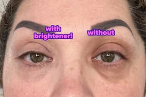 reviewer photo of one eye with visible dark circles around it and the other brighter and clearer after using the brightener
