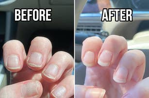 Before and after comparison of nails, post manicure, showcasing their improved appearance