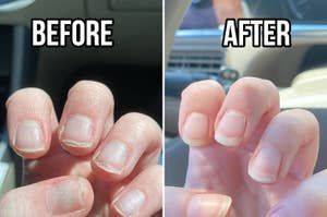 Before and after comparison of nails, post manicure, showcasing their improved appearance