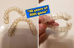 reviewer's before photo of dirty Invisalign / after photo of them clean because of the tablets