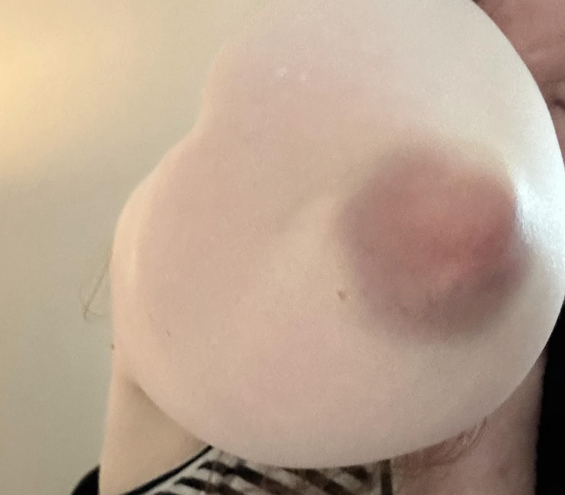 Person blows a large bubble with bubblegum, obscuring part of their face