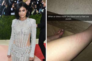 Kylie Jenner at the Met Gala, her Snapchat showing scratches on her leg from her dress