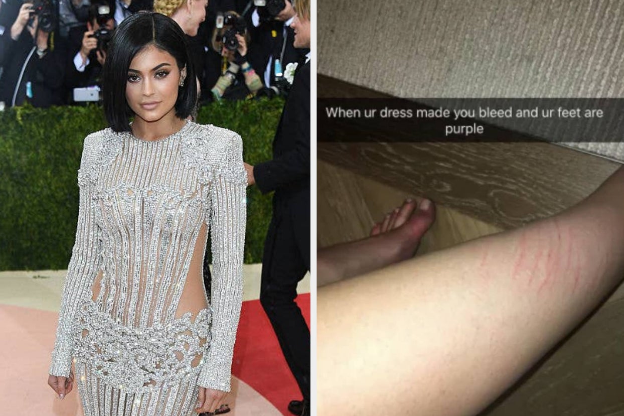 13 Times Celebs' Past Met Gala Looks Caused Injury Or Made It Hard To Breathe Or Move