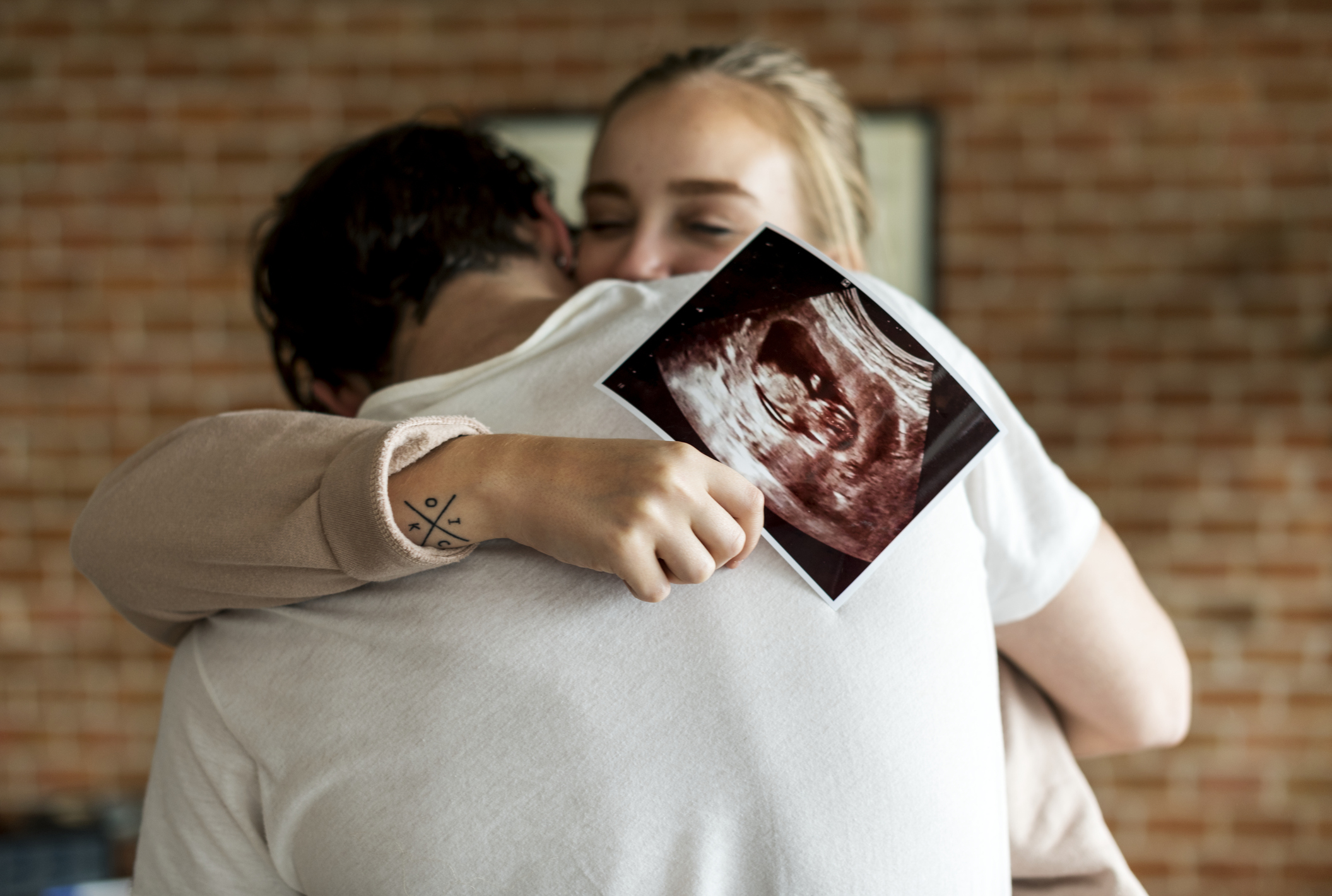Couple embracing and holding an ultrasound image, suggesting pregnancy