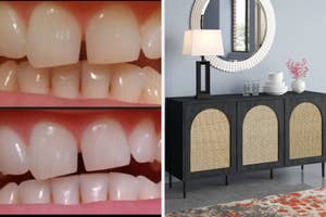 Close-up before and after images show improved teeth alignment. On the right, a modern sideboard with a lamp, mirror, and decor sits in a stylishly furnished room