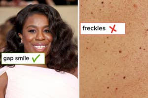 Uzo Aduba smiles in a photo with "gap smile" text and a check mark overlaid. Close-up of freckles with "freckles" text and an X mark
