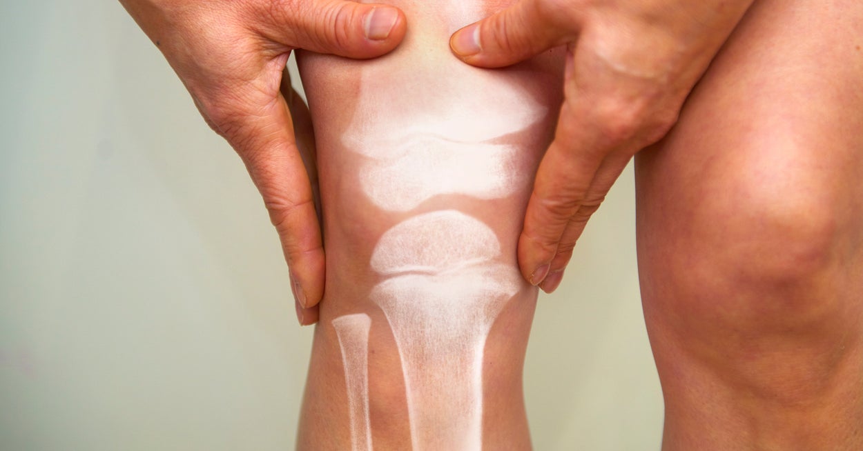 8 Things Knee Doctors Say You Should Never, Ever Do