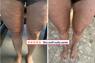 before/after of legs looking much smoother after using the bumbum cream