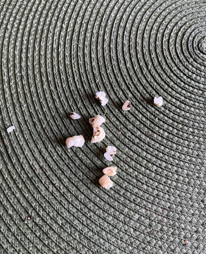 Broken dental crowns and fragments scattered on a textured surface
