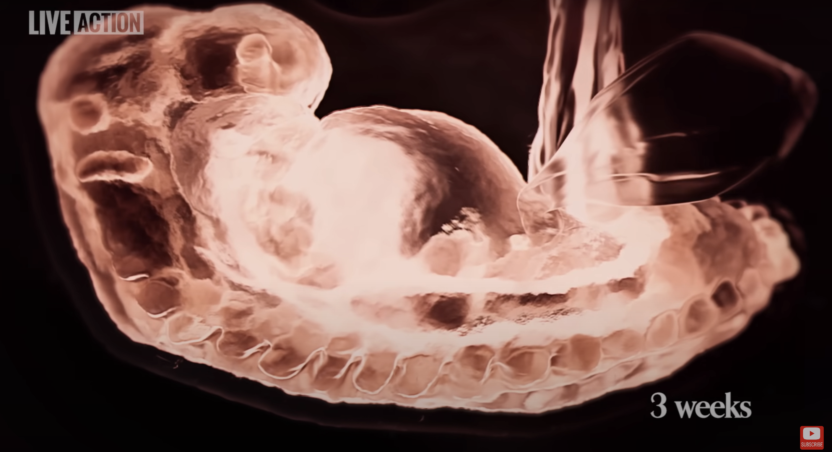 A close-up image of a developing human embryo