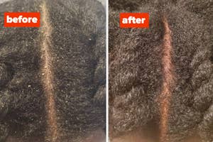 a before and after for a dandruff shampoo
