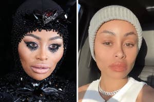 Blac Chyna before and after dissolving her fillers