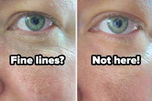 Close-up of a person's eyes, one with visible fine lines and one without, suggesting a skincare product result