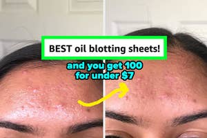 Before and after comparison of reviewer's skin using oil blotting sheets "Best oil blotting sheets! And you get 100 for under $7"