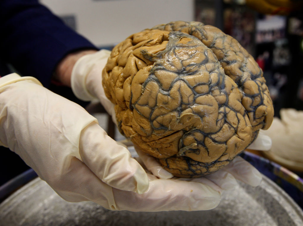 Gloved hands holding a human brain for demonstration