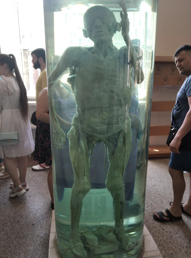 Exhibit of a preserved human body in a standing position, with onlookers observing