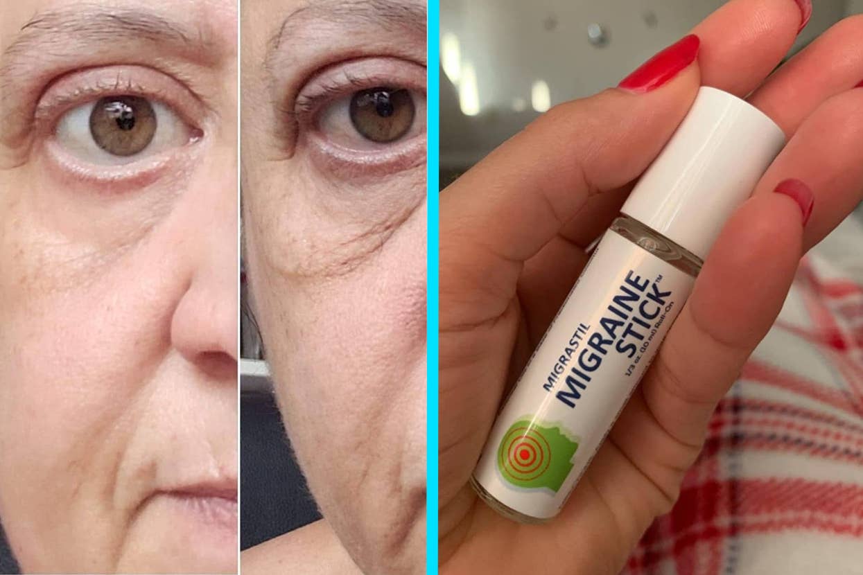 Close-up before and after images of a person's under-eye area, alongside a hand holding a "MegaStick Migraine Stick" product