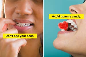 Split image with text. Left side: Close-up of a person biting their nails, text reads "Don't bite your nails." Right side: Close-up of a person with a gummy candy between their teeth, text reads "Avoid gummy candy."
