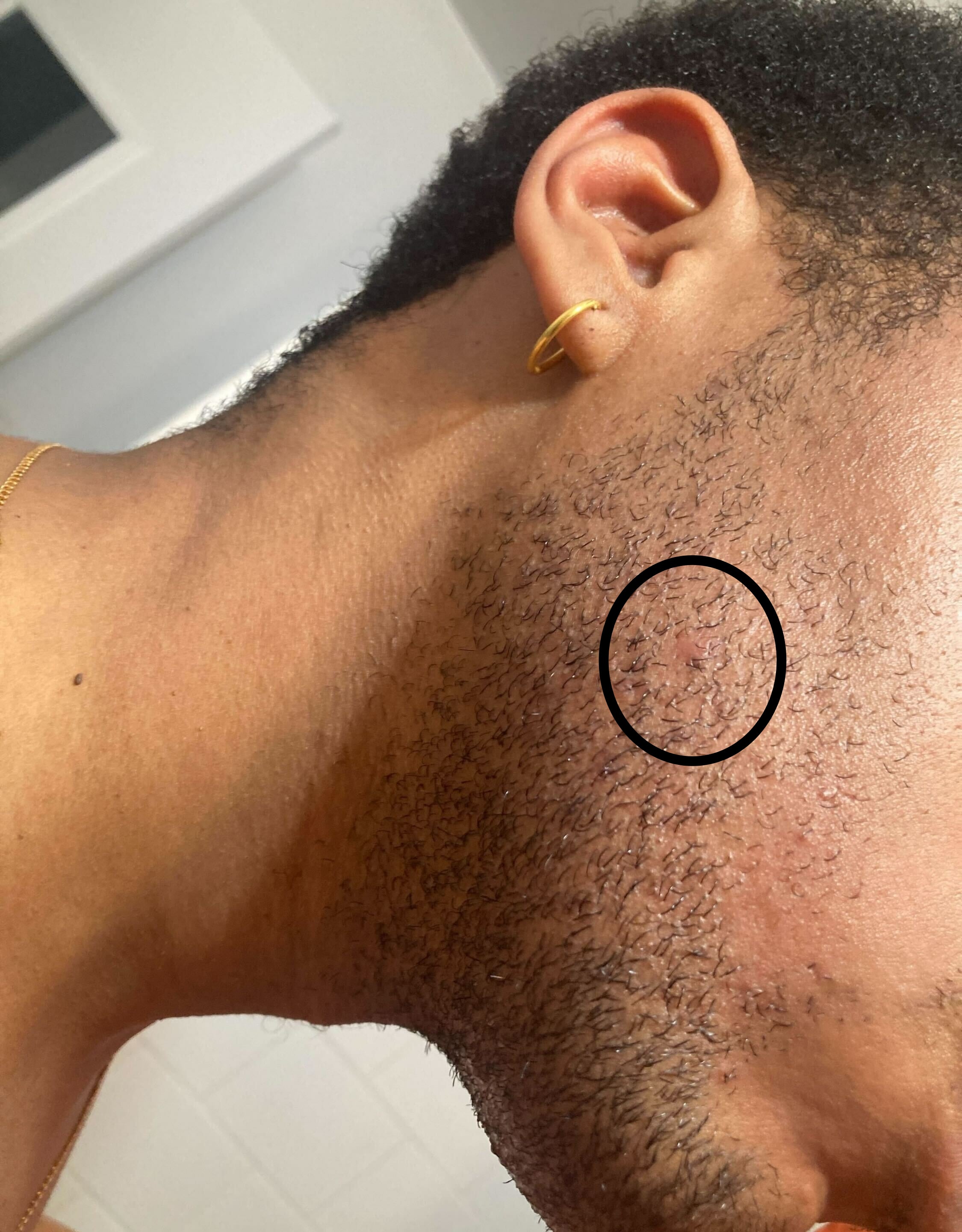 Close-up of a person's jawline and neck, showing facial hair growth and a gold earring. The person's head is turned slightly, revealing skin texture and a necklace