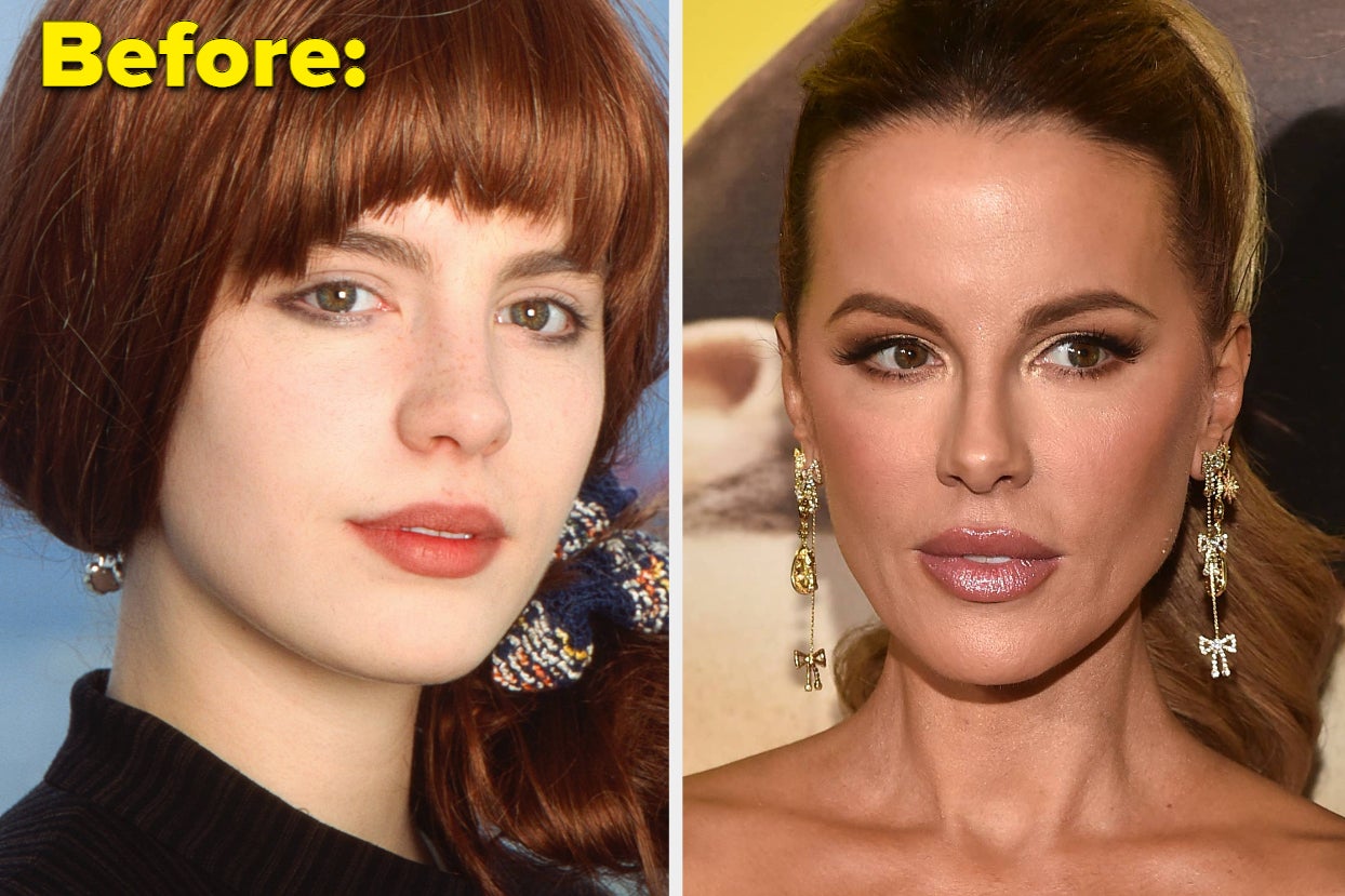Kate Beckinsale Explained Her "Different" Appearance Between Now And Her 20s After Fans Speculated She Got Botox And Filler