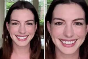 Anne Hathway with long hair smiling, before and after teeth whitening comparison