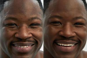 Before and after close-up of a man's smile, showcasing teeth whitening results