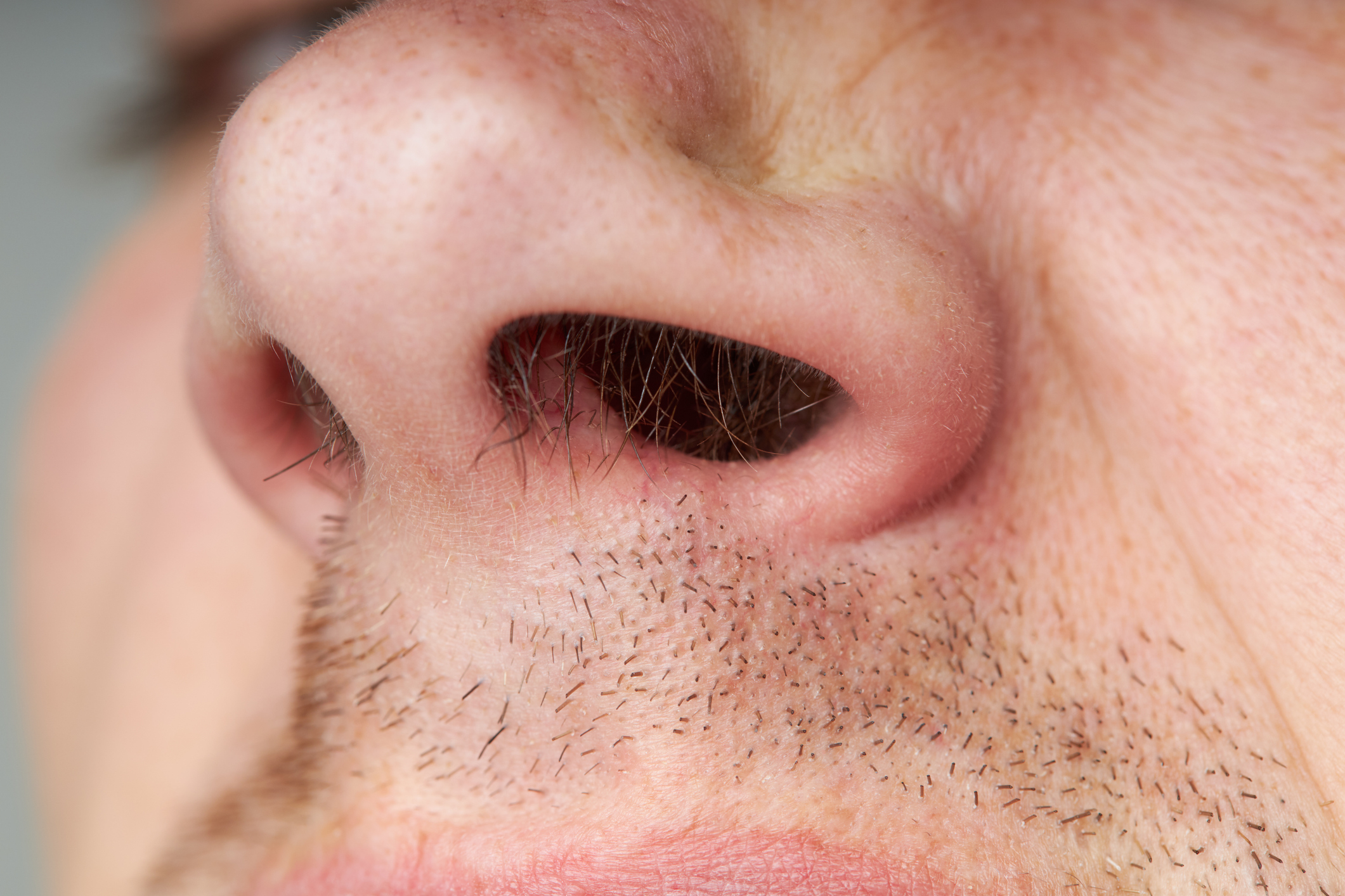 Close-up of a person&#x27;s nose area showing pores and hair follicles