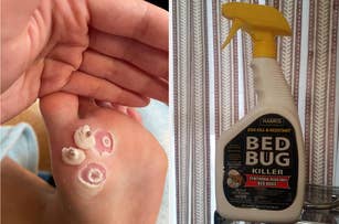 wart bandages and a bed bug killer spray