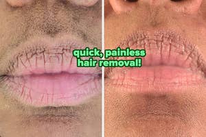 left: reviewer before photo of upper lip with visible dark hair / right: after using electric trimmer, hair is gone and skin is smooth